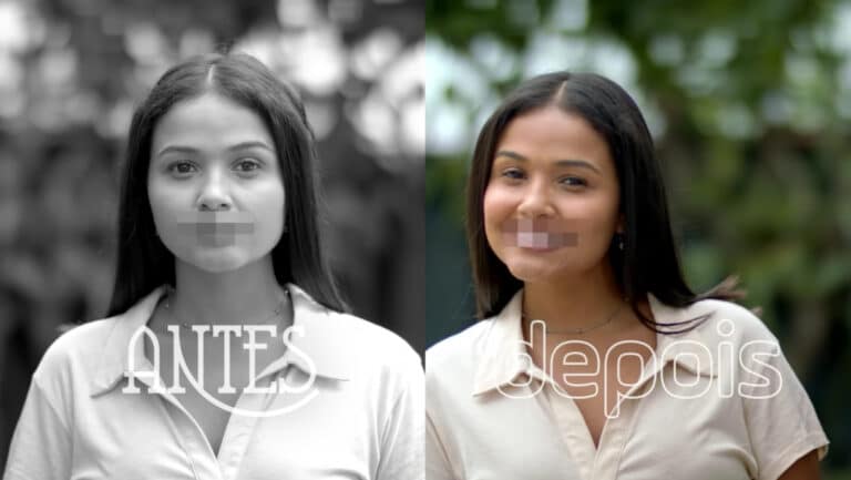 Smilink brinca com o proibido “antes e depois” na odontologia